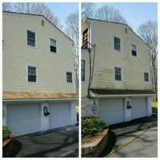 Before & After Photos 37